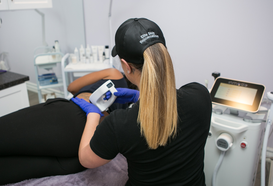 Coolsculpting Toronto